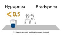 MedEd capnography byte 13: Hypopnea with bradypnea