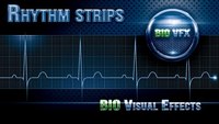 How to calculate heart rate with 6-second ECG strip