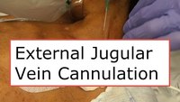How to cannulate the external jugular vein 
