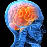 Stroke Care