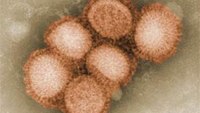 4 swine flu outbreak scenarios and how to prevent them