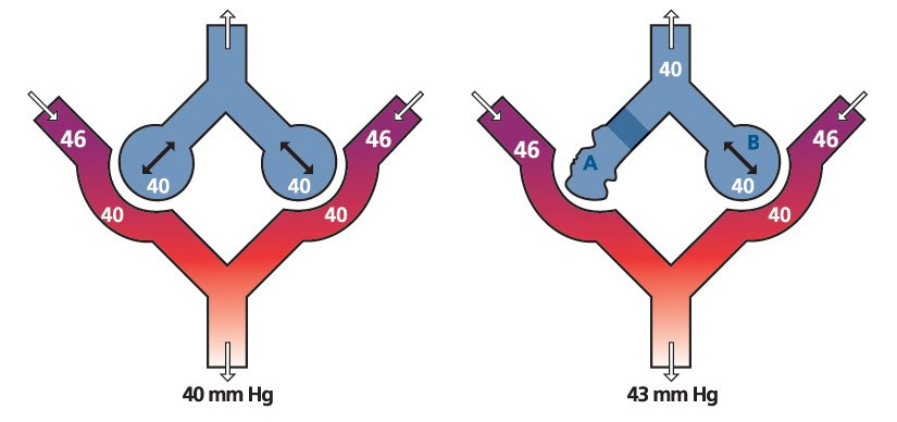 Capnography encompasses more than just ventilations – it also includes perfusion. (image/Medtronic)