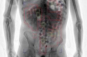 ADANI Systems’ DruGuard feature shows anomalies in the body and uses color highlights to help COs spot concealed drugs.
