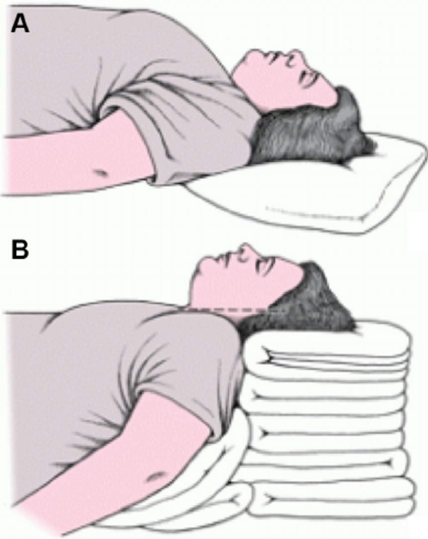 (Figure 1/Courtesy Hoefnagel, Amie & Yu, Albert & Kaminski, Anna. (2016). Anesthetic-Complications-in-Pregnancy 2016 Critical-Care-Clinics)
