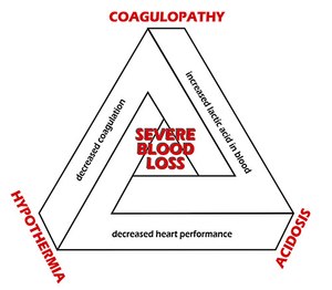 Treatment hypovolemic shock