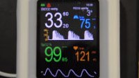 Cardiogenic Oscillations on VM-2500V capnograph pulse oximeter